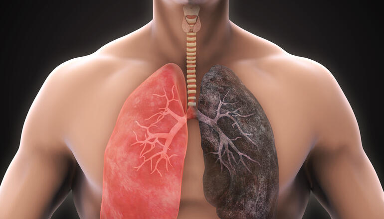 pulmones